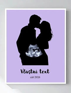 Personalizovaný magický fotob obraz v ráme – 40x50 – s párom a ultrazvukom