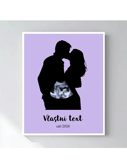 Personalizovaný magický fotorámik – štvorcový 40x50 – s párom a ultrazvukom