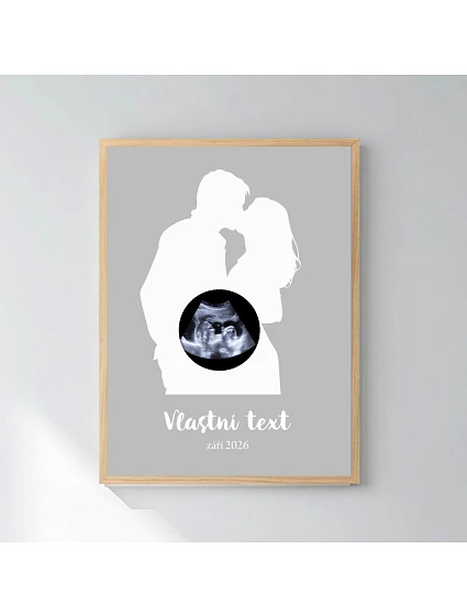 Personalizovaný magický fotorámik – štvorcový 30x40 – s párom a ultrazvukom