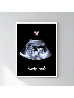 Personalizovaný magický fotorámik – 30x40 – ultrazvuk