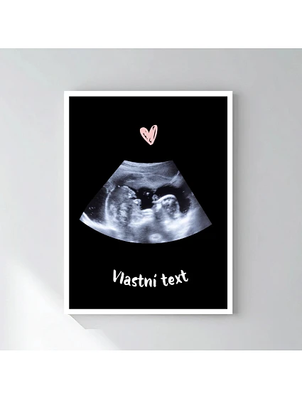 Personalizovaný magický fotorámik – 30x40 – ultrazvuk Personalizovaný magický fotorámik – 30x40 – ultrazvuk
