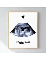 Personalizovaný magický fotob obraz v ráme – 50 × 70 – ultrazvuk Personalizovaný magický fotob obraz v ráme – 50 × 70 – ultrazvuk
