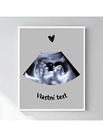 Personalizovaný magický fotob obraz v ráme – 50 × 70 – ultrazvuk Personalizovaný magický fotob obraz v ráme – 50 × 70 – ultrazvuk