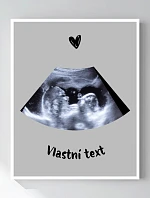 Personalizovaný magický fotob obraz v ráme – 50 × 70 – ultrazvuk