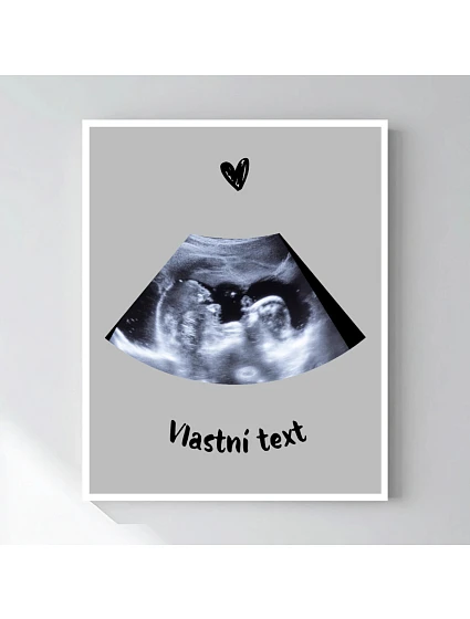 Personalizovaný magický fotob obraz v ráme – 50 × 70 – ultrazvuk Personalizovaný magický fotob obraz v ráme – 50 × 70 – ultrazvuk
