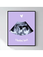 Personalizovaný magický fotob obraz v ráme – 50 × 70 – ultrazvuk Personalizovaný magický fotob obraz v ráme – 50 × 70 – ultrazvuk