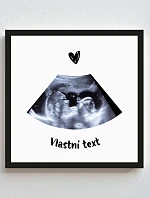 Personalizovaný magický fotob obraz v ráme – štvorcový 20x20 – ultrazvuk